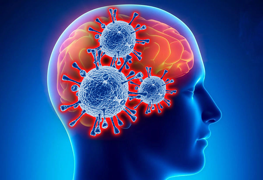 Мозг, выпадение волос, бесплодие. Как коронавирус влияет на здоровье человека